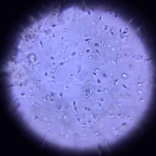 TENGA MENS LOUPE精子质量观察器 男性精子活力精液液化密度放大镜情趣用品精子检测 商品图1