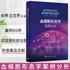 血细胞形态学案例分析 商品缩略图0