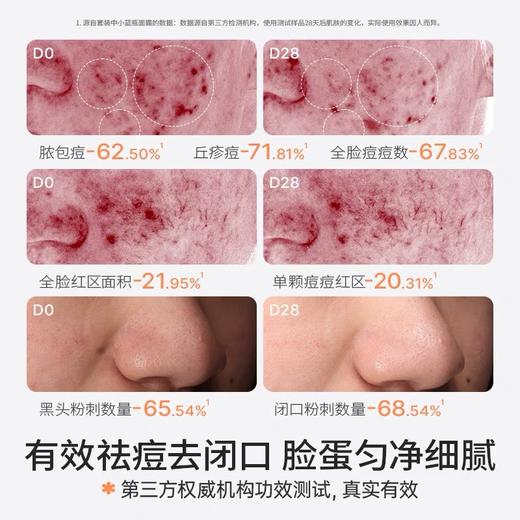 【品牌直发】Hi!papa海龟爸爸青少年祛痘水乳护肤套装男学生青春期女孩控油儿童洗面奶 商品图5