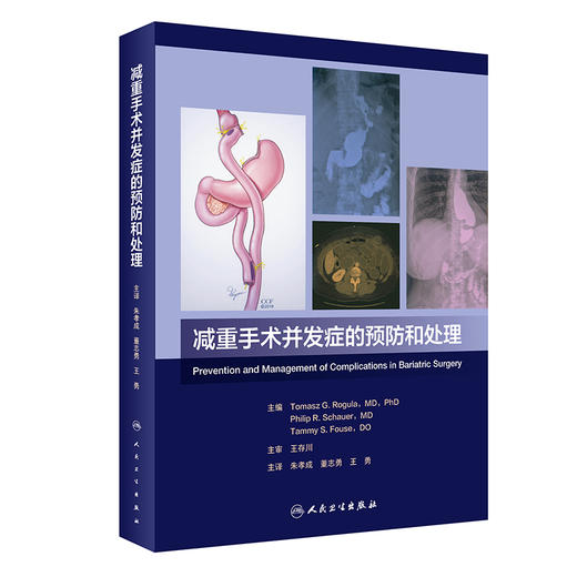 减重手术并发症的预防和处理 商品图0