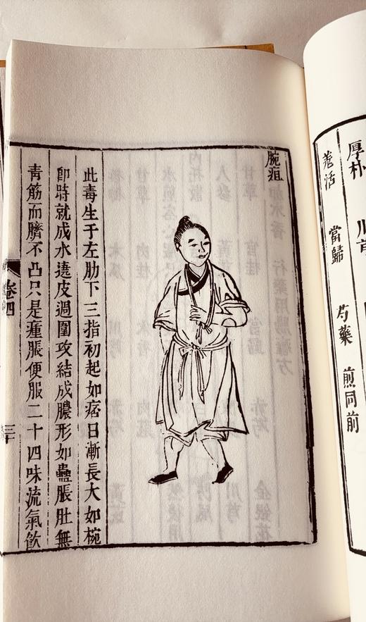 清咸丰本《外科图说》 商品图7