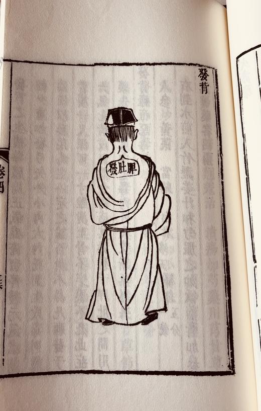 清咸丰本《外科图说》 商品图12