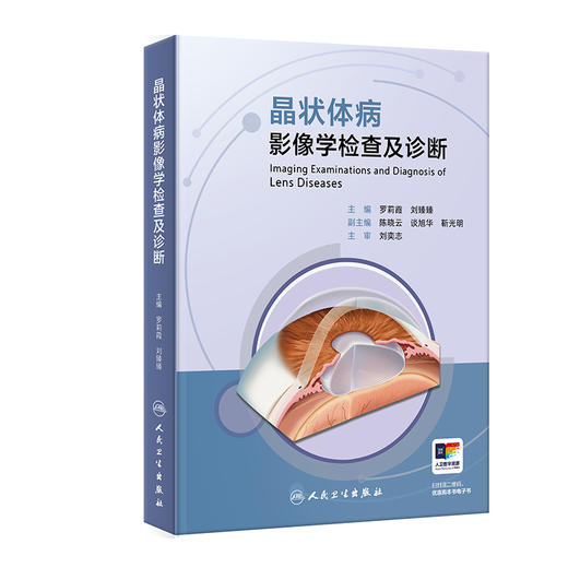 晶状体病影像学检查及诊断 商品图0