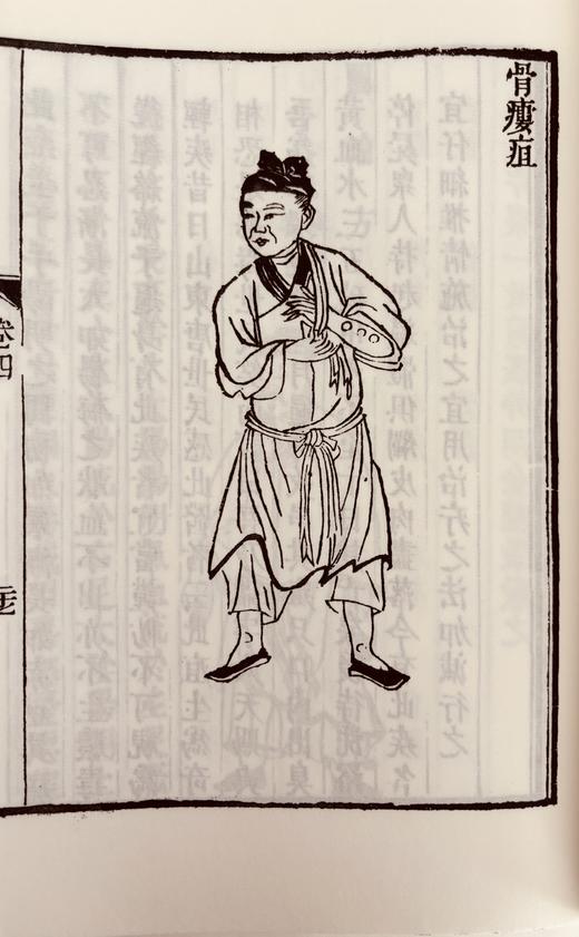 清咸丰本《外科图说》 商品图11