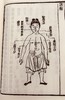 清咸丰本《外科图说》 商品缩略图5