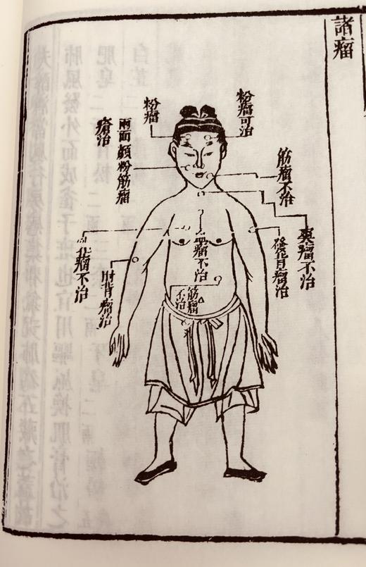 清咸丰本《外科图说》 商品图5