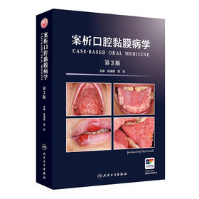 案析口腔黏膜病学 第3版