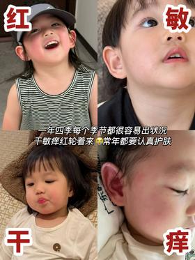 春夏敏感肌自救指南