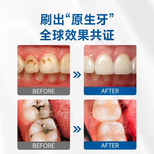 德国Weissta再生牙膏 呵护口腔健康  2盒装/4盒装（100g/盒） 商品图8