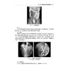 腹部疾病影像征象及危急值 王勇 主编 内容涵盖了X线 CT和MRI等多种常用影像技术的图像阅读 数据测量及报告描述等重要基础知识等 商品缩略图4