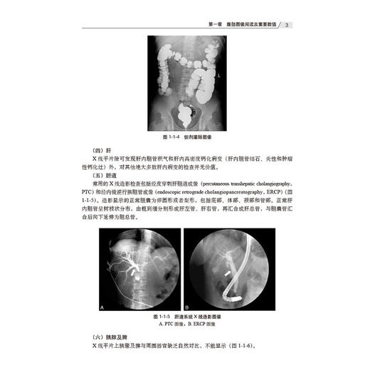 腹部疾病影像征象及危急值 王勇 主编 内容涵盖了X线 CT和MRI等多种常用影像技术的图像阅读 数据测量及报告描述等重要基础知识等 商品图4