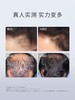 hairmax 系列生发仪合集  LaserBand41/82 商品缩略图3