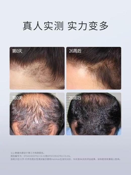 hairmax 系列生发仪合集  LaserBand41/82 商品图3