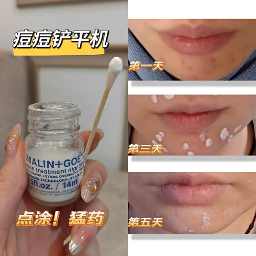 【清仓好价】马林戈茨夜间祛痘精华14ml（效期至26.3） 商品图4