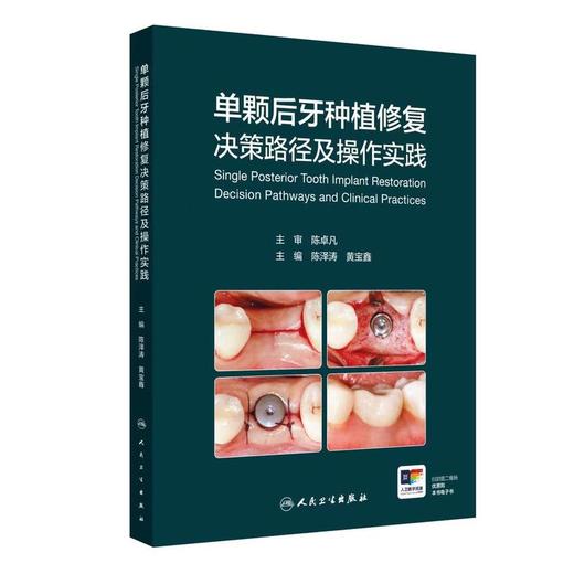 单颗后牙种植修复决策路径及操作实践 主编陈泽涛 黄宝鑫 商品图0