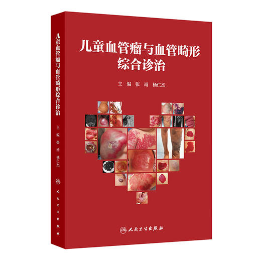 儿童血管瘤与血管畸形综合诊治 商品图0