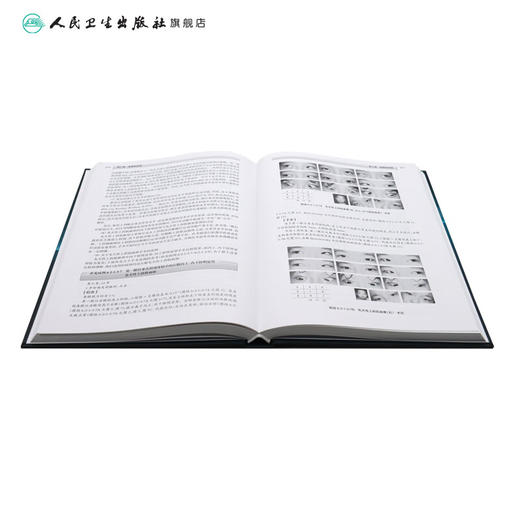 斜视诊断与手术详解（第2版）胡聪 刘桂香主编 与斜视相关的基础知识及概念 婴儿性内斜视 9787117272193人民卫生出版社 商品图4
