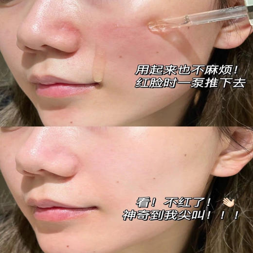 林清轩 · 新品爆珠精油抗皱舒缓爆珠精华油 10ml 商品图3