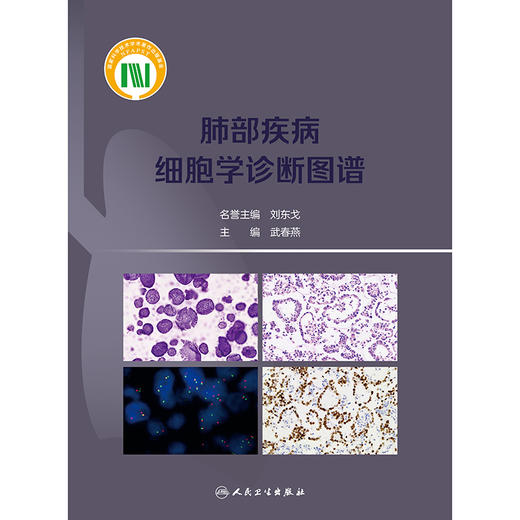 【预售】肺部疾病细胞学诊断图谱 商品图1