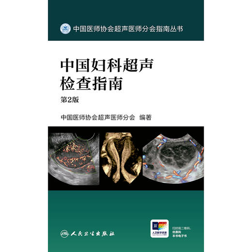 中国妇科超声检查指南（第2版） 商品图1