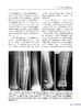 骨肿瘤手术学：病例图解 商品缩略图4