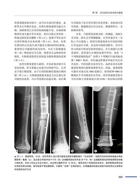 骨肿瘤手术学：病例图解 商品图4
