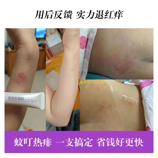 宝莉佳儿紫草胶紫草膏宝宝蚊虫叮咬止痒消红膏舒缓儿童婴儿紫草素 商品图4