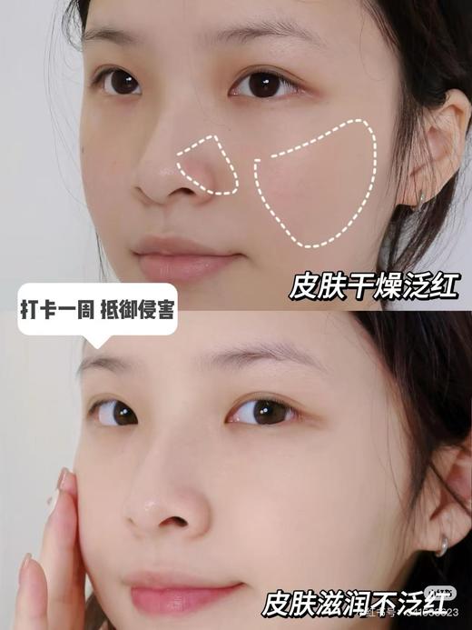 【4.26王炸割肉价】资生堂新品红妍肌活益生菌冻干粉66g益生菌（30条）（效期至26.2） 商品图2