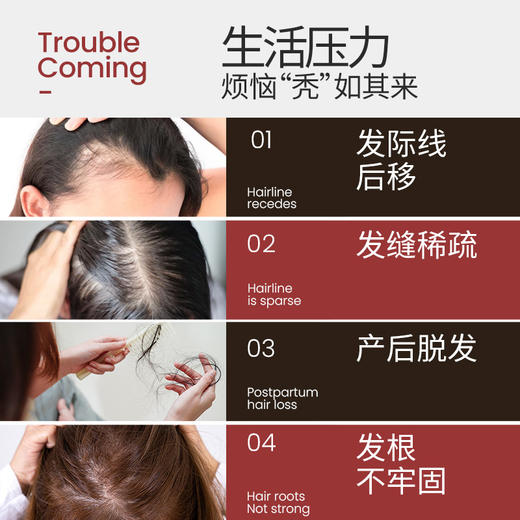 【Smeal】补铁生物素加强版养发丸（0.5g*16片/盒） 商品图3