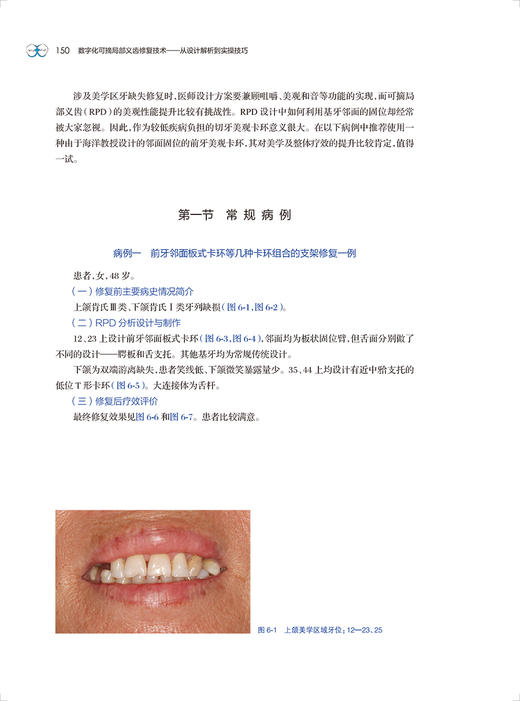 数字化可摘局部义齿修复技术 从设计解析到实操技巧 华西手把手学好美学种植功能修复案析丛书第二册 于海洋9787117326544人民卫生出版社 商品图3