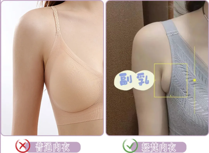 副乳对比.jpg