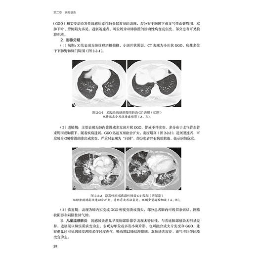 感染与炎症放射诊断学 案例解析版 李宏军 主编 供专科医师培训使用 并提供学习线索和视频等内容 9787117371841 人民卫生出版社 商品图4