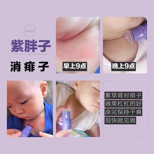 采华之滋天然蜂蜜紫草膏（小紫胖）4.5g 商品图9