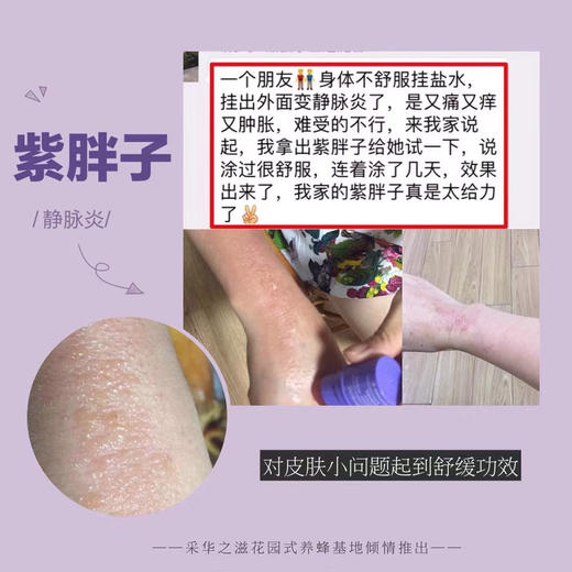 采华之滋天然蜂蜜紫草膏（小紫胖）4.5g 商品图3