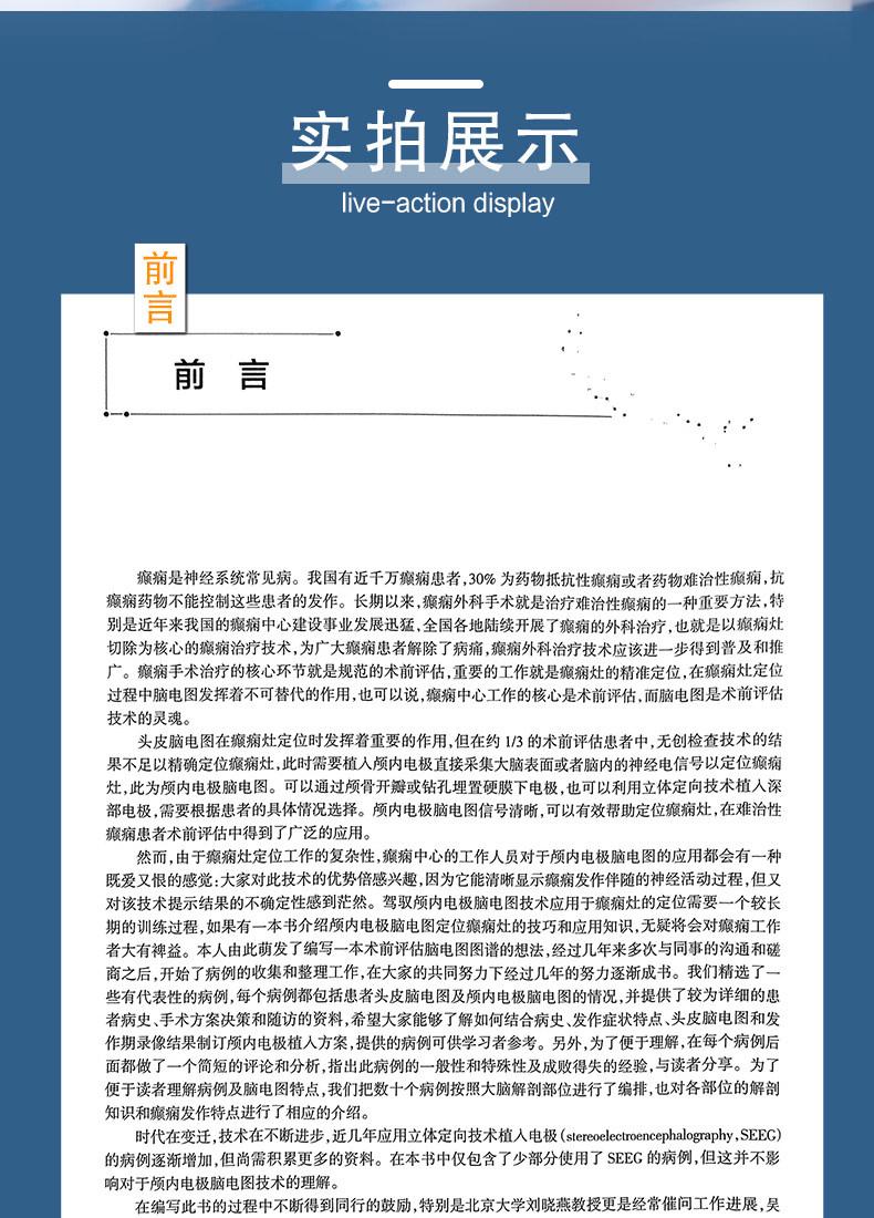 9787117321068-癫痫术前评估脑电图图谱_04.jpg