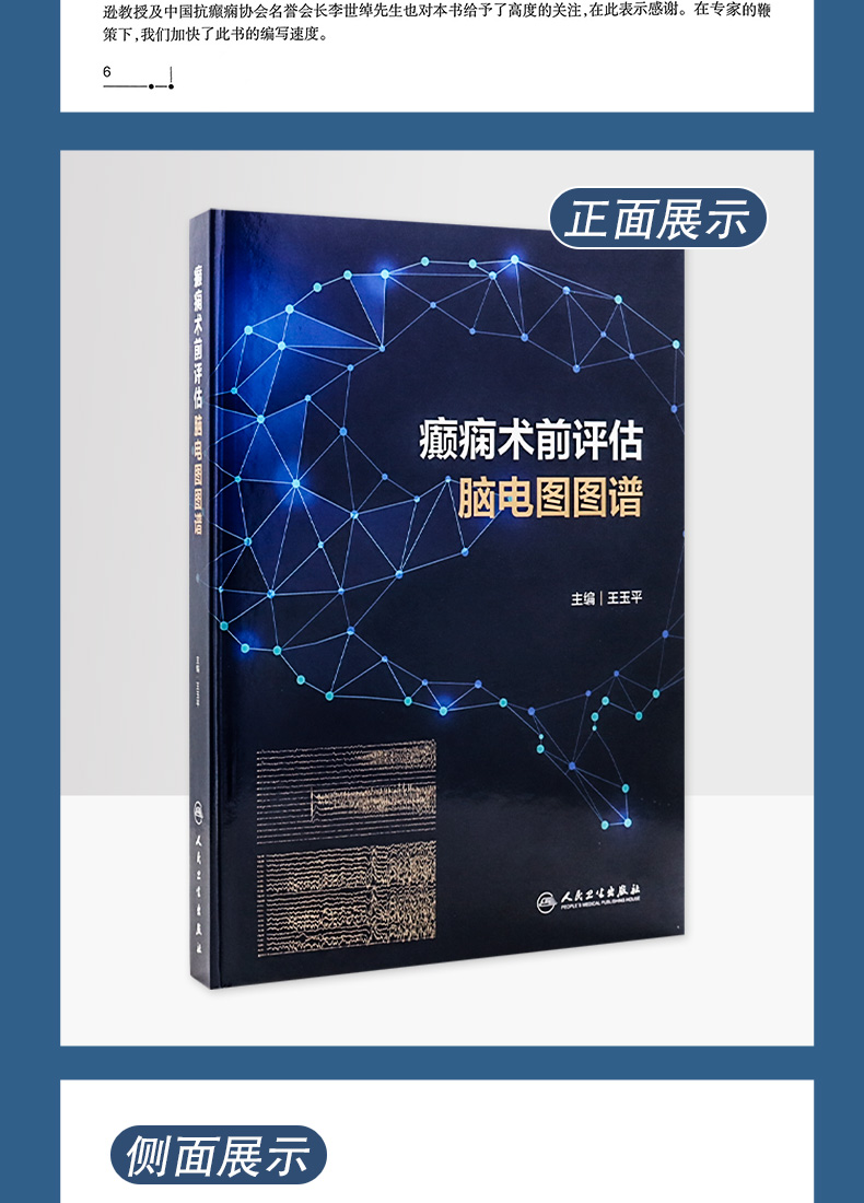 9787117321068-癫痫术前评估脑电图图谱_05.jpg