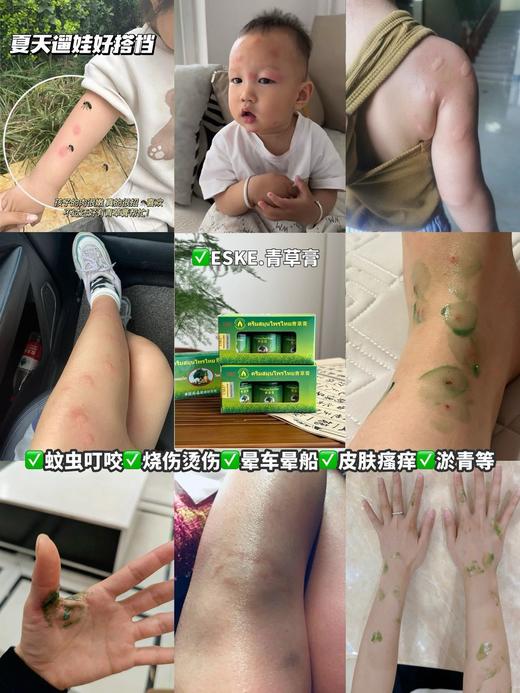 【泰国 ESKE青草膏】泰国秘方配制，天然植物成分，温和不刺激!携带方便行走的防蚊器!驱蚊止痒/防晕车/提神醒脑/修复晒伤烫伤/缓解疲劳/统统搞定！不含樟脑!成分更温和！一年四季，居家必备，超实用 商品图3