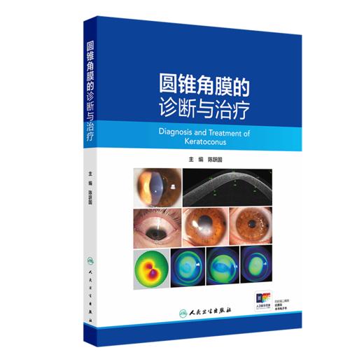 全2册 圆锥角膜+圆锥角膜的诊断与治疗 可作为临床眼科医师视光学医师医学院校学生学习和工作的参考书 眼科学 人民卫生出版社 商品图3