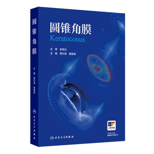 全2册 圆锥角膜+圆锥角膜的诊断与治疗 可作为临床眼科医师视光学医师医学院校学生学习和工作的参考书 眼科学 人民卫生出版社 商品图2