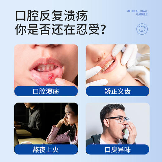 复因医用口腔溃疡含漱液 200ml （薄荷味） 口腔溃疡清新口气 商品图1