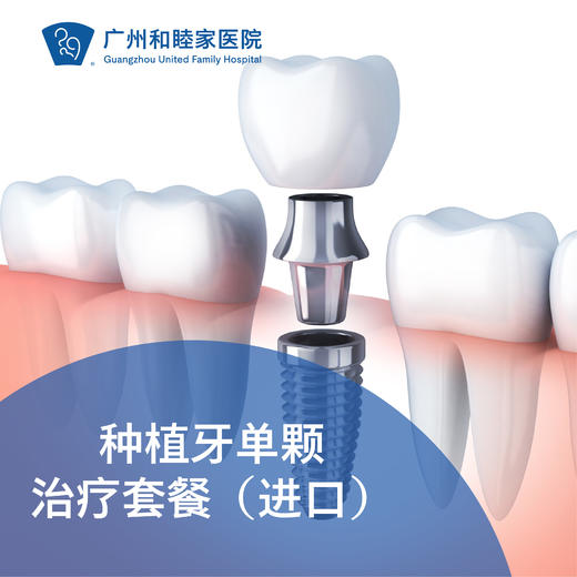 种植牙单颗治疗套餐（进口） DENT07_口腔科 商品图0