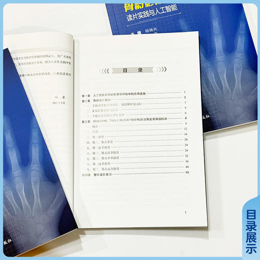 骨龄影像学读片实践与人工智能 程晓光 编 系统解析RUS-CHN、TW3-C RUS和TW3 RUS法骨发育等级评估标准等 中国协和医科大学出版社 商品图3