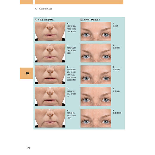 图解富血小板血浆（PRP）微针再生美容实用指南(德)伯纳德·C.科尔斯特 主编 附加内容二维码 9787559140579辽宁科学技术出版社 商品图4