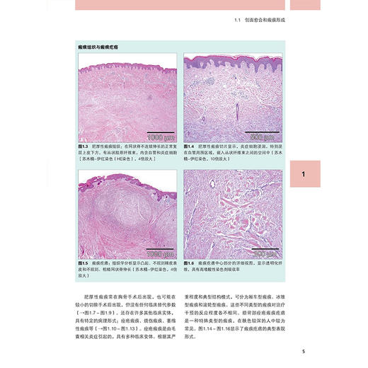 图解富血小板血浆（PRP）微针再生美容实用指南(德)伯纳德·C.科尔斯特 主编 附加内容二维码 9787559140579辽宁科学技术出版社 商品图2