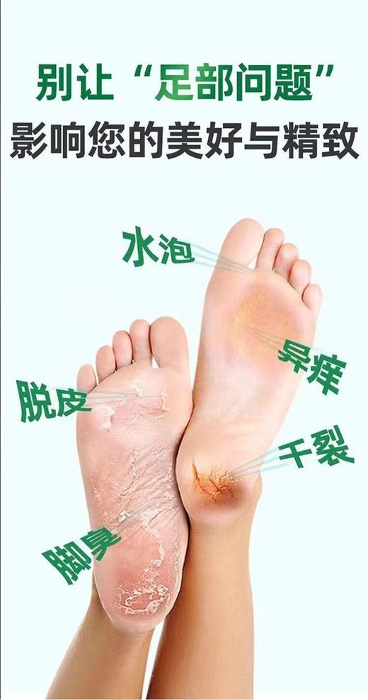 狼毒草本脚气中药膏16.8元1瓶50g，明天到 商品图5