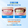 奥乐V牙膏护牙剂 | 软性摩剂、温和清洁、改善黄黑牙、不伤牙、适合12岁+ 商品缩略图1