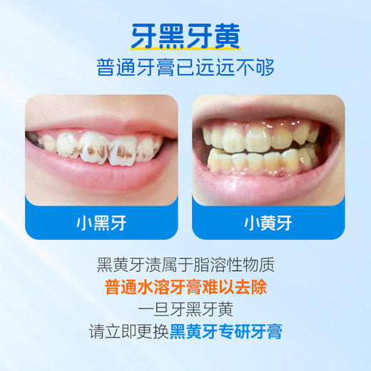 奥乐V牙膏护牙剂 | 软性摩剂、温和清洁、改善黄黑牙、不伤牙、适合12岁+ 商品图1