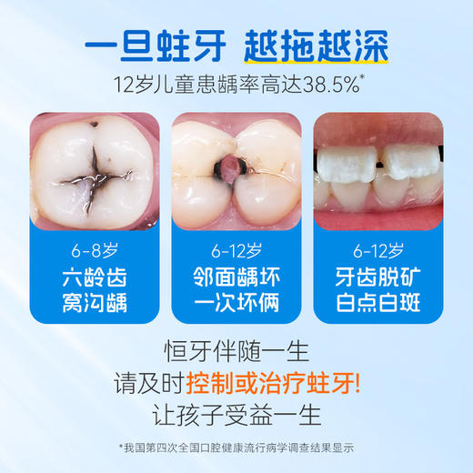 奥乐V儿童牙膏护牙剂 | 含氟1000ppm、软性摩剂、温和清洁、改善黄黑牙、不伤牙、适合6-12岁【HZ】 商品图1