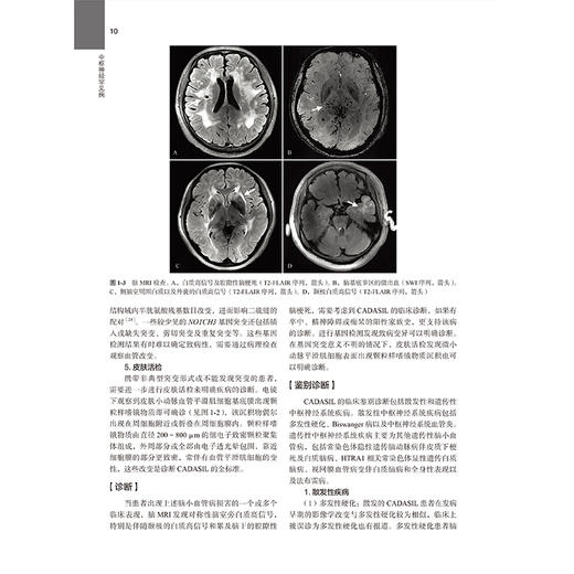 中枢神经罕见病 罕见病丛书 袁云 中枢神经系统免疫病 中枢神经系统营养缺乏 中枢神经增生疾病 9787565933523北京大学医学出版社 商品图4