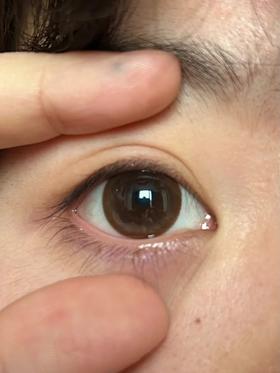 jelly doll半年抛美瞳 茶叶蛋 14.5mm